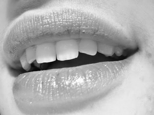 Dentist Branchburg - Branchburg Dental 6 Featured image