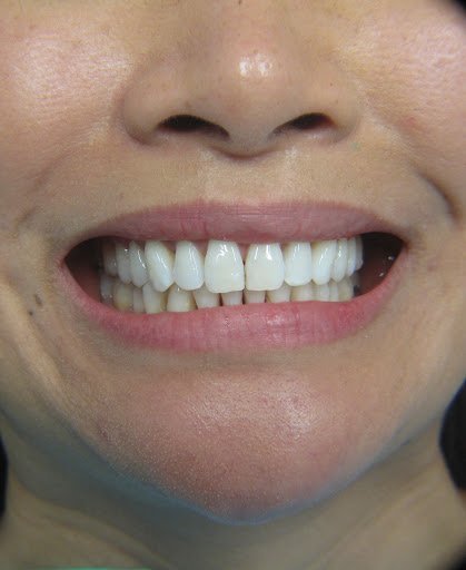 Cosmetic dentist One Loudoun - Leesburg Spa Dentistry 2 Featured image