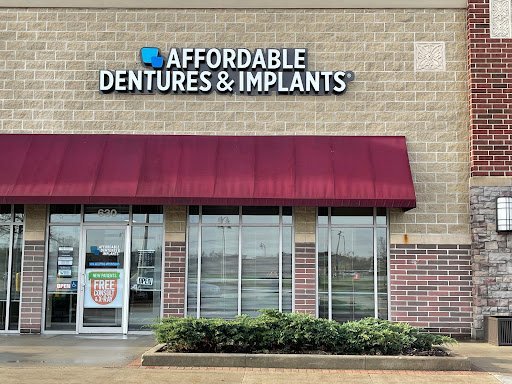 Dentist Pleasant Prairie - Affordable Dentures & Implants 5 Featured image