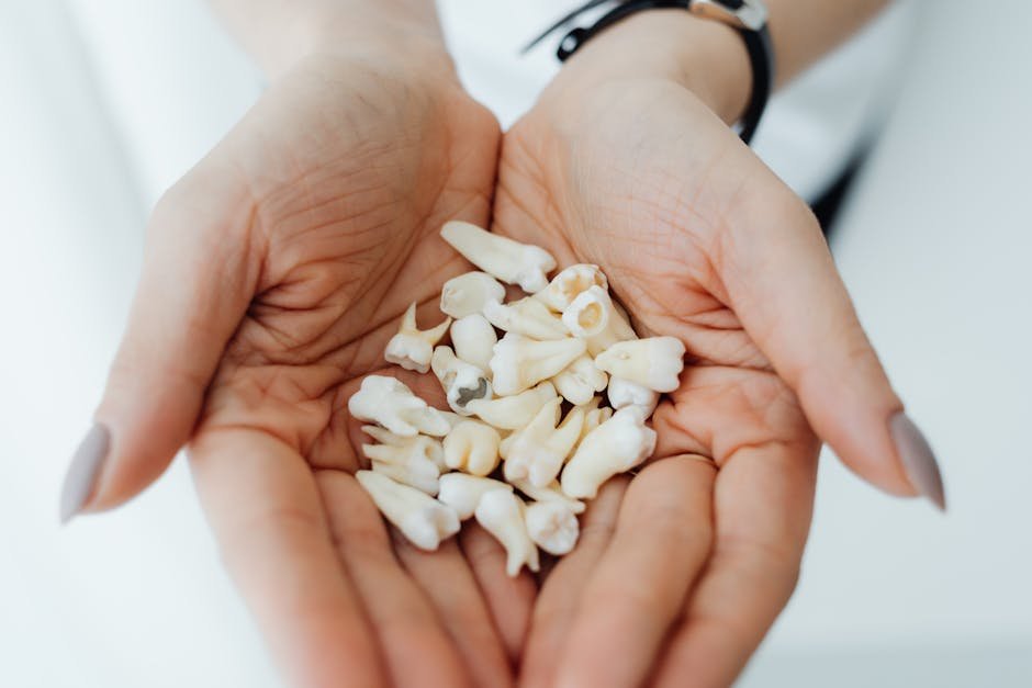 wisdom tooth extraction — Wisdom Tooth Extraction: What to Expect